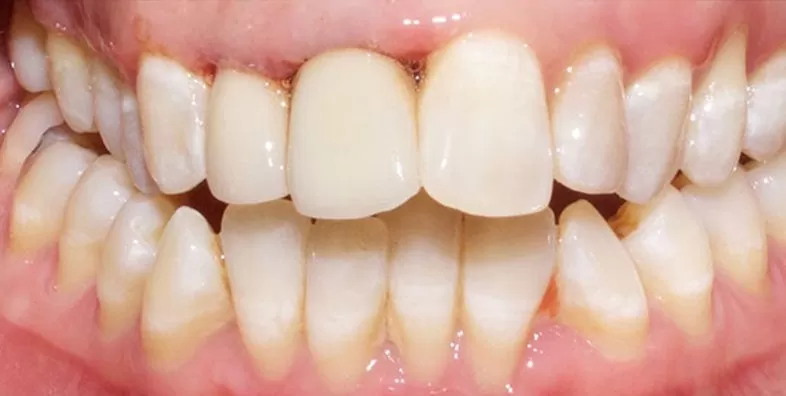 Intraoral-AFTER.jpg