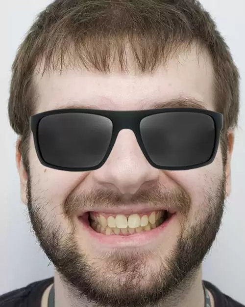 Smile-after-treatment-.jpg